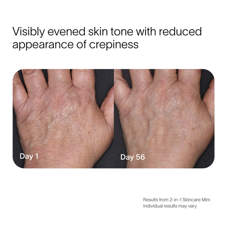 Before and after, skin