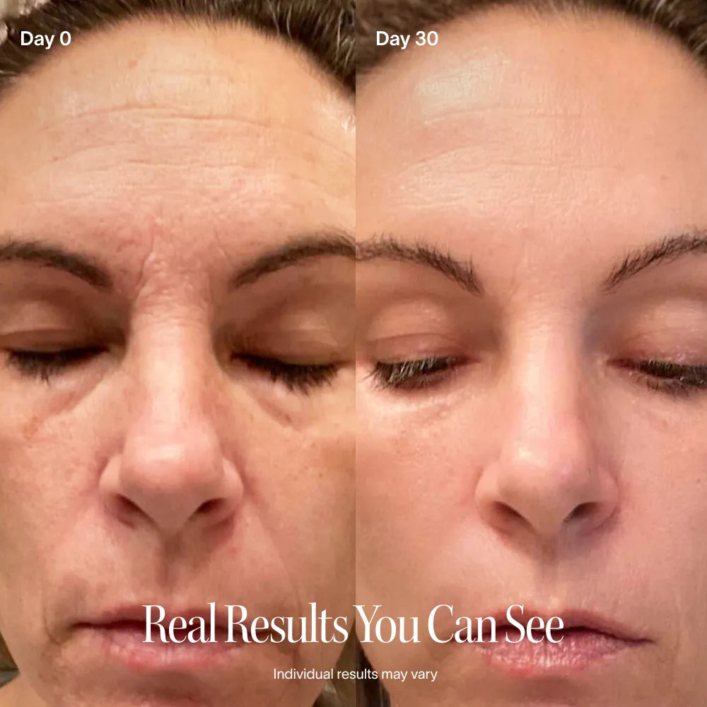 Before and after, full face