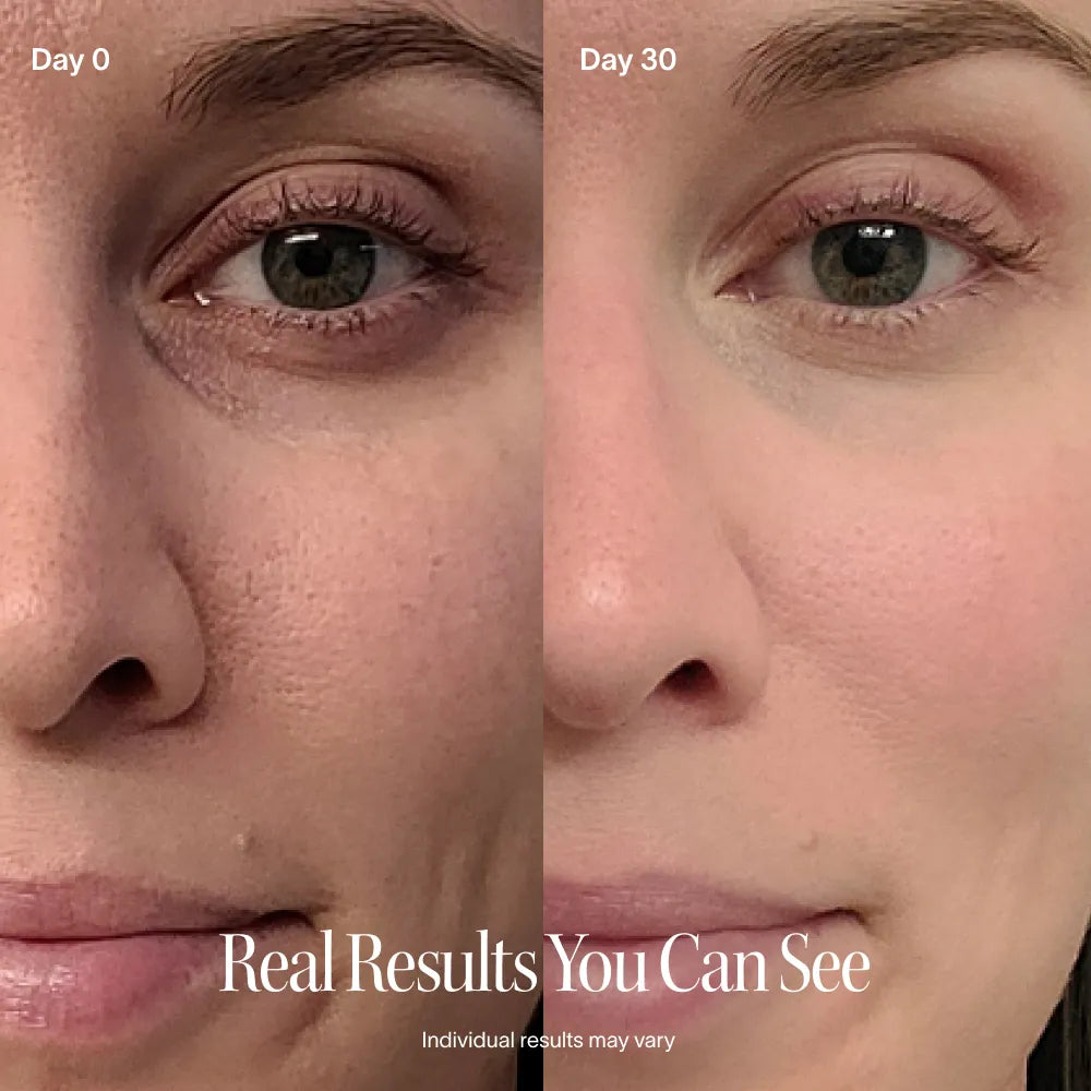 Before and after, skin close-up