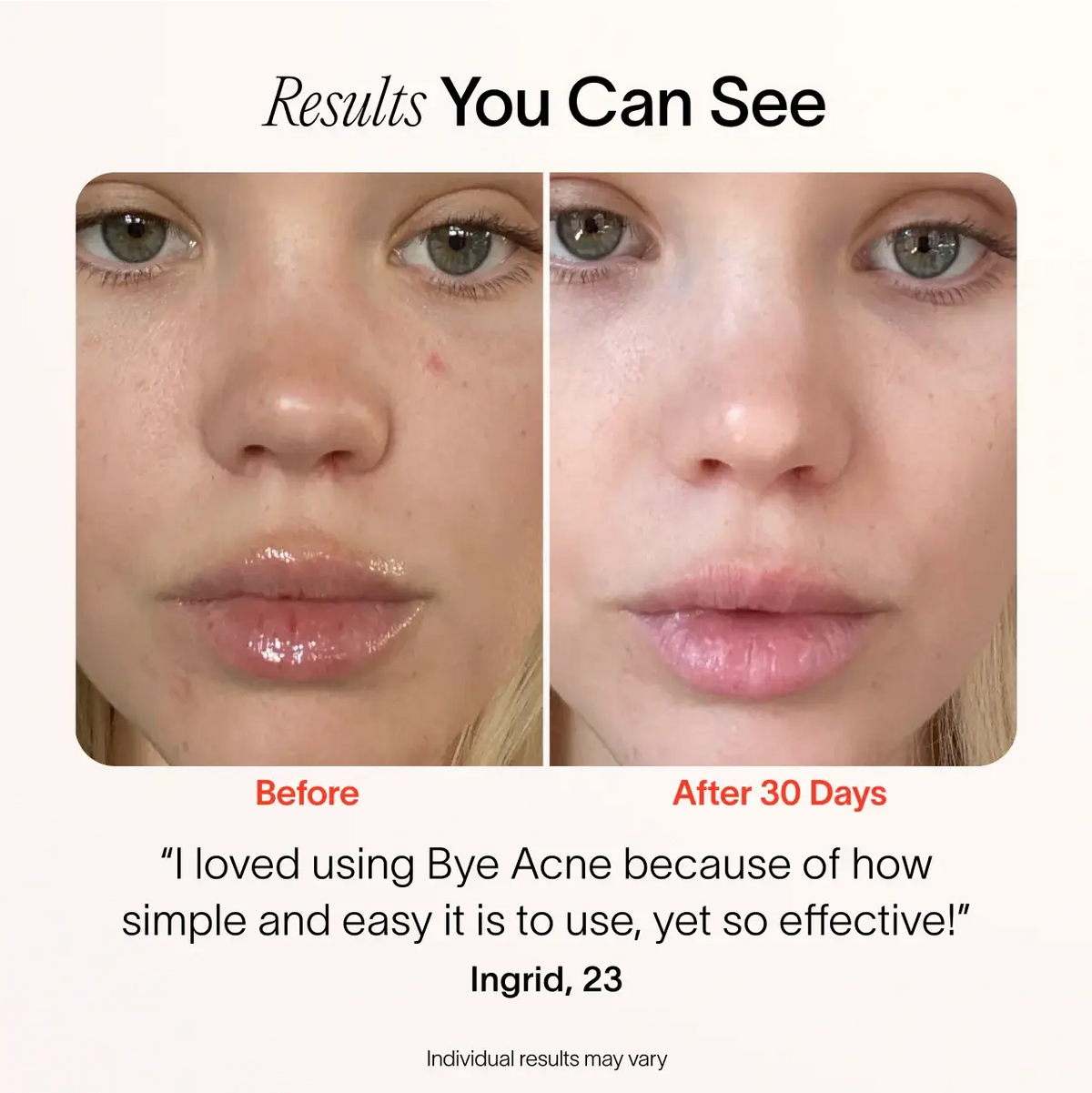 Before and after, testimonial